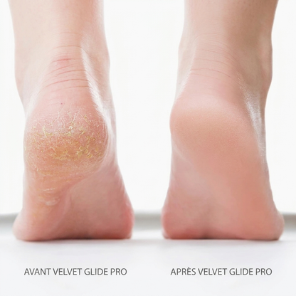 Velvet Glide Pro – Des pieds tout doux, sans passer par l'institut