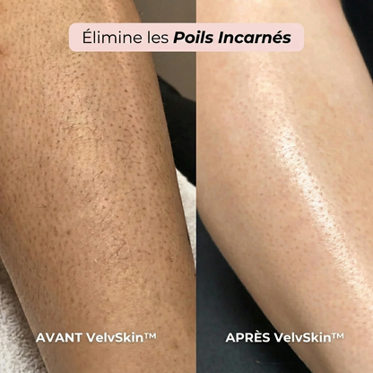 Tondeuse 2 en 1 Maillot et Corps VelvSkin™