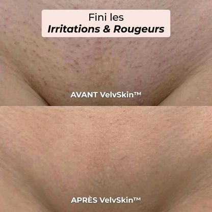 Tondeuse 2 en 1 Maillot et Corps VelvSkin™