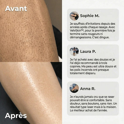 Tondeuse 2 en 1 Maillot et Corps VelvSkin™